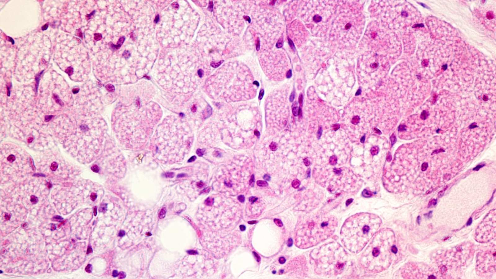 Adiposit Nedir Cesitleri Nelerdir Adipozyten: Anatomie, Histologie und Funktion